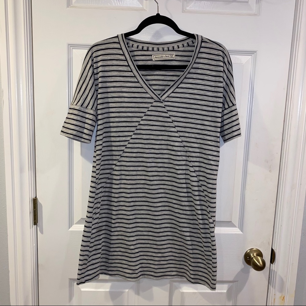 Abercrombie and Fitch Striped Tunic